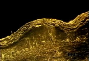 Watch living epidermal cells near the dermis push old cells toward the skin surface to die and become keratin protein