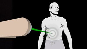 Compare radiation treatments external beam therapy with brachytherapy and learn about their side effects